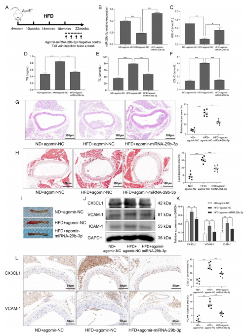 層流剪切應力通過調控 miR - 29b - 3p/CX3CL1 軸減輕單核細胞黏附及動脈粥樣硬化發展
